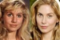 Elizabeth Mitchell Plastic Surgery Before and After